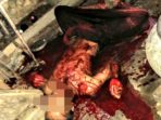 Di Duga Depresi Ardi Gorok Lehernya Gunakan Pisau.